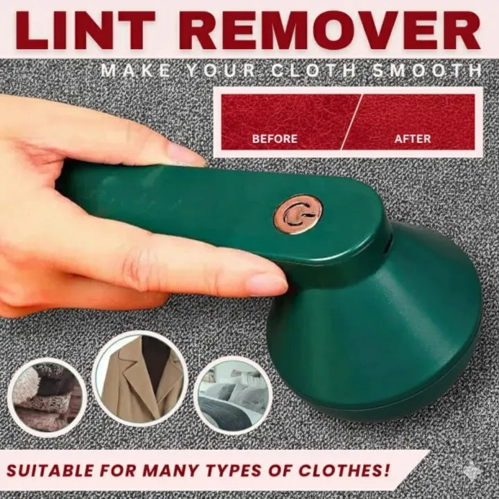 O'Zone Electric Lint Remover - O'ZONE